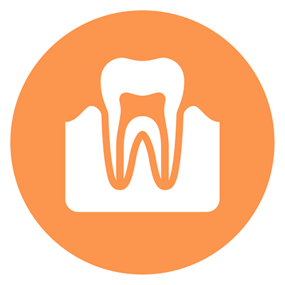 Odontoiatria conservativa ed endodonzia
